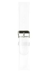 Redmi Watch 5 Active  / Lite Uyumlu Şeffaf Silikon Kordon Şık ve Estetik Kayış